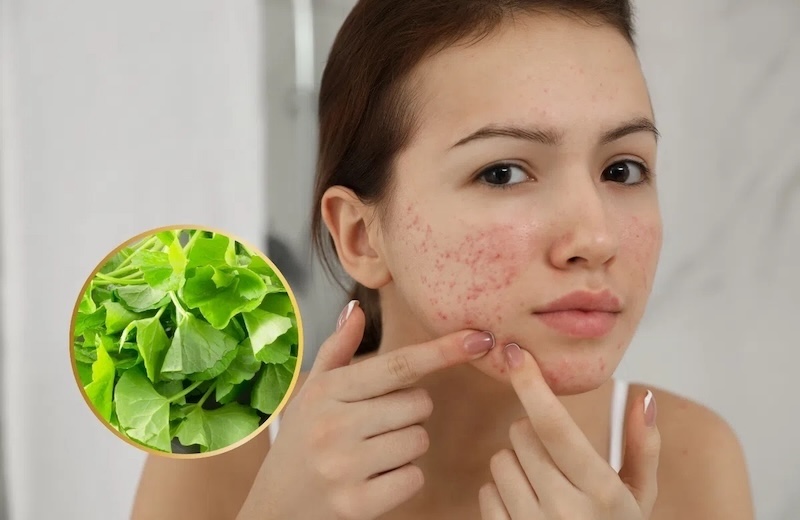 Rau má có tác dụng gì cho da mặt rau ma co tac dung gi cho da mat