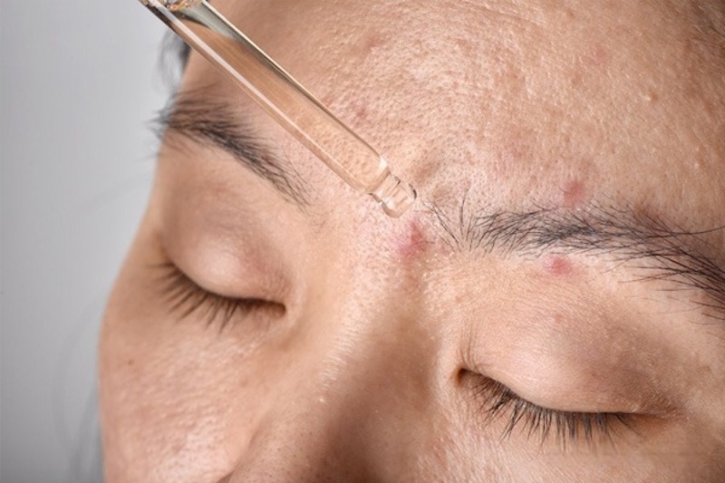 Rau má có tác dụng gì cho da mặt rau ma co tac dung gi cho da mat