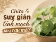 Chữa suy giãn tĩnh mạch bằng rau má có hiệu quả không?